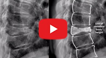 Virtual Meet the Doctor with Dr. Rivka Lomedico with youtube play button
