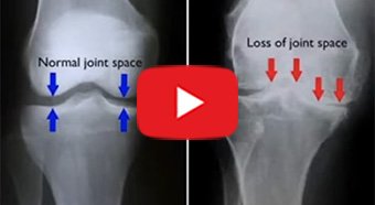 Virtual Meet the Doctor with Dr. Jarvis Yau with youtube play button