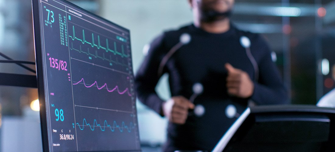 Patient running on a treadmill connected to heart monitoring equipment