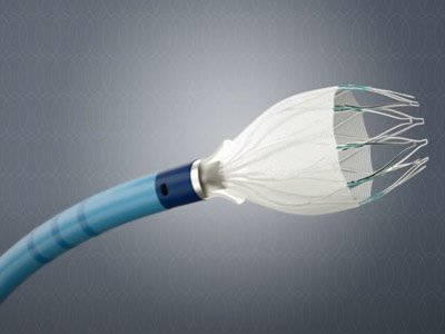 Watchman - Left Atrial Appendage Closure Device