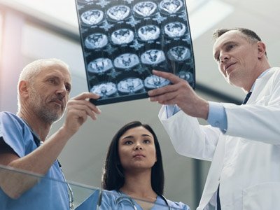 Photo of neurology care team reviewing brain scans