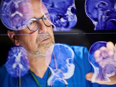 Photo of a doctor analyzing brain scans