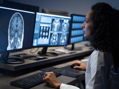 Photo of provider reviewing brain scans on a computer monitor