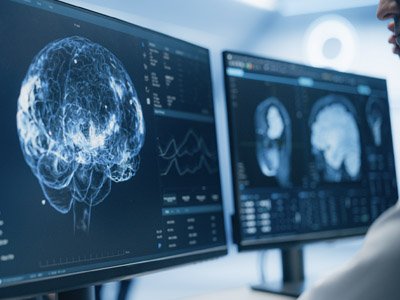 Photo of computer screens with brain scans