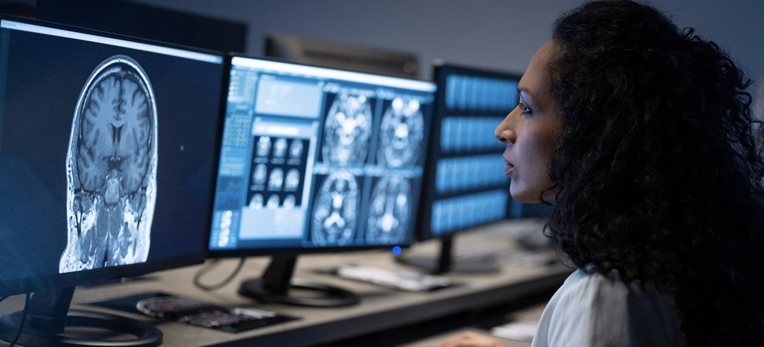 Photo of a provider viewing a computer monitor with a brain scan image