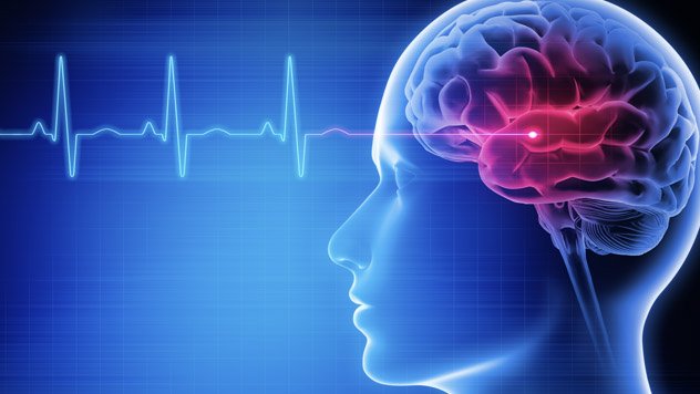 Illustration of a brain scan