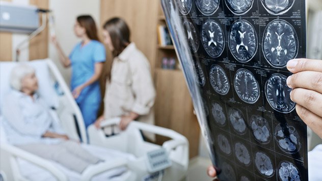 Team of providers next to a patient bed with one provider holding brain scans